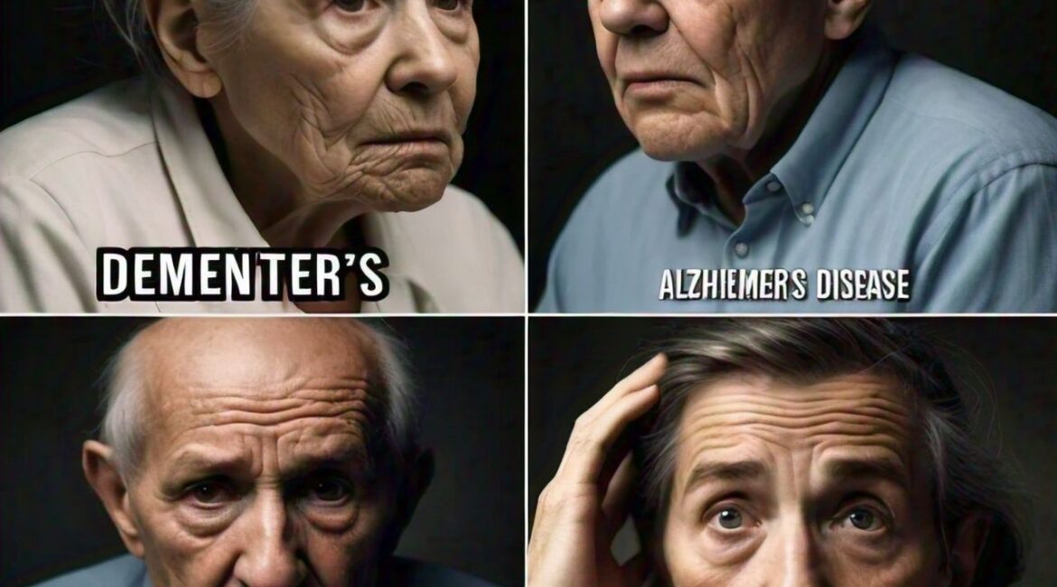 dementia and alzheimers disease